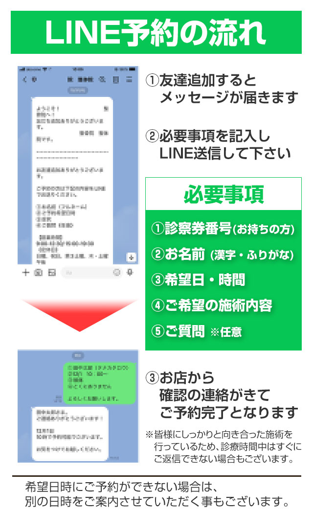 LINE予約の流れ